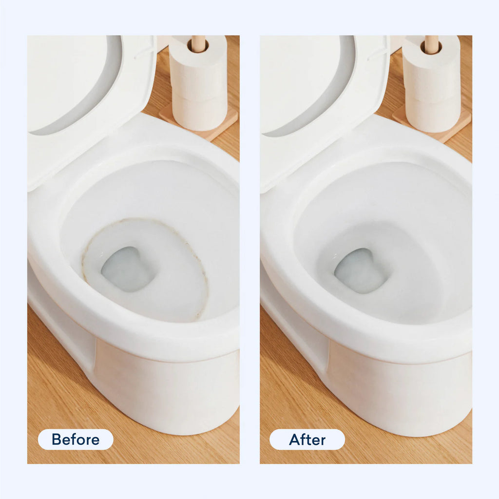 Toilet Bowl Cleaner Starter Set