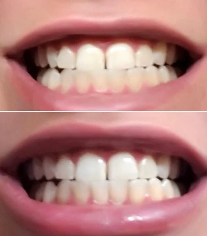 Charcoal Toothpaste