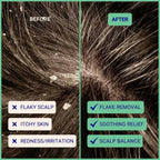 Exfoliating Shampoo For Loose Dandruff Flakes Tea Tree & Salicylic Acid 70g / 2.47oz